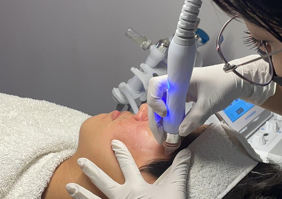 HIDRAFACIAL CON DERMAPLANIN