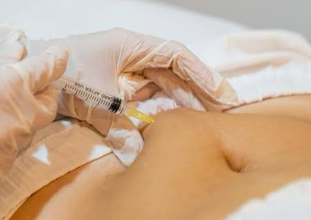 MESOTERAPIA REDUCTORA,REAFIRMANTE ENTRE OTRAS 