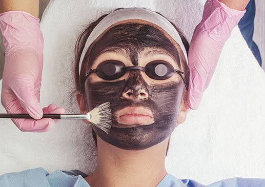 LIMPIEZA PROFUNDA CON HOLLYWOOD PEEL