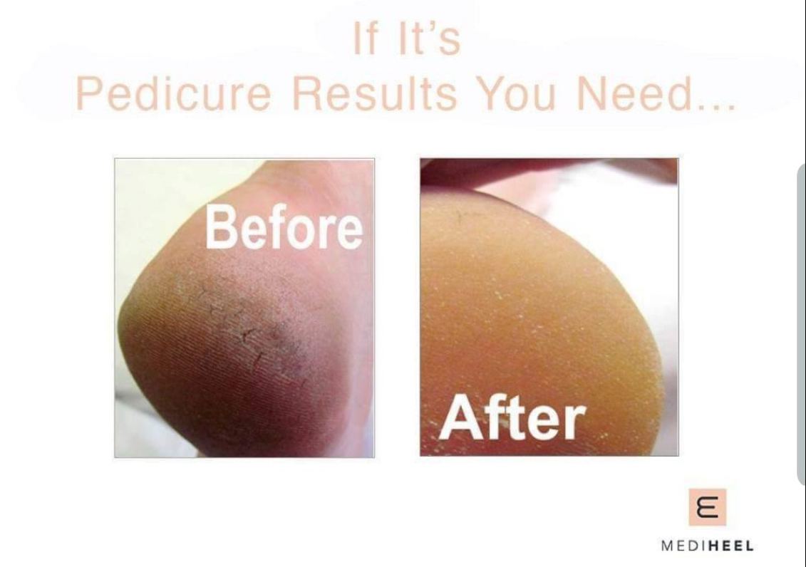 Medi-Heel Pedicure (No Gel Toes) & Foot Massage