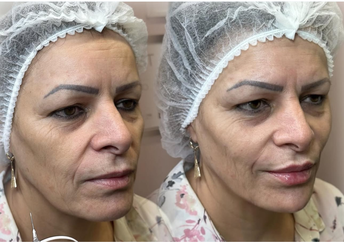 ✨ 8.8ml – Ultimate Transformation Package