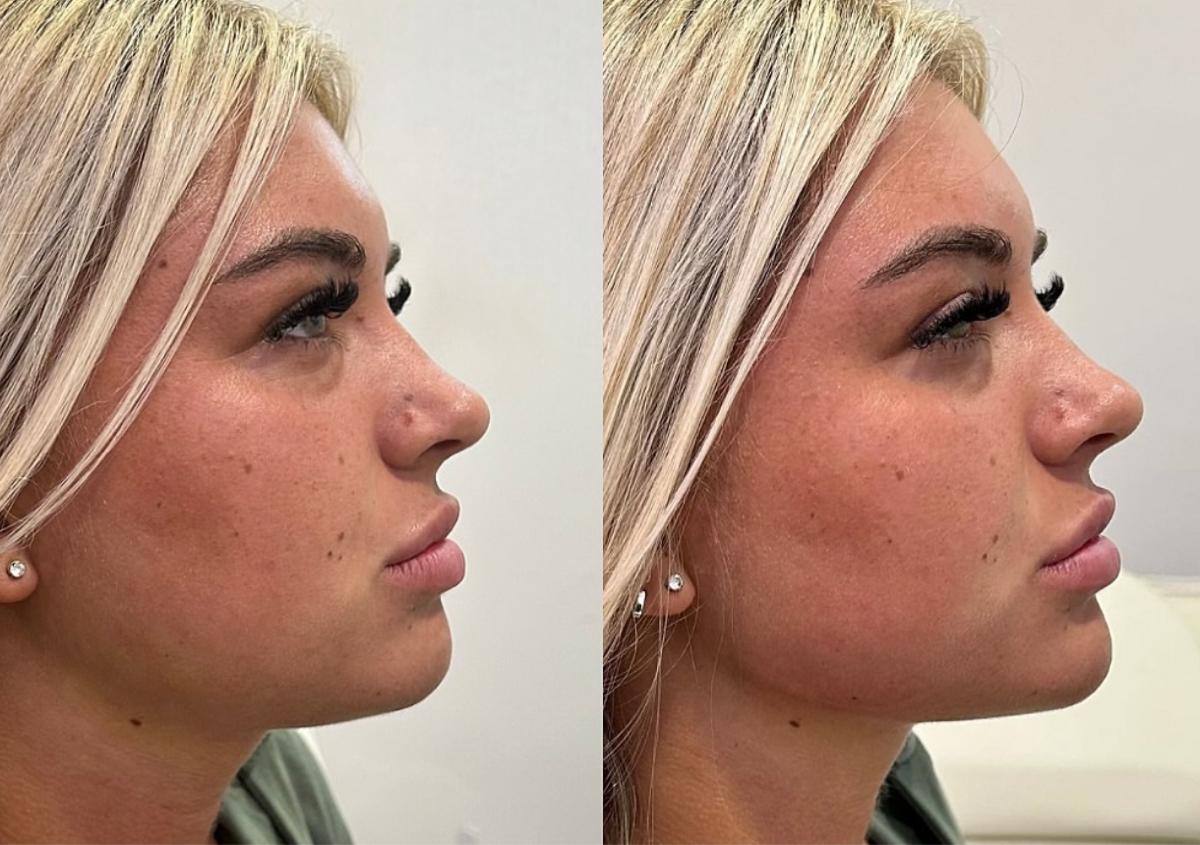 ✨ 6.6ml – Transform & Sculpt Package