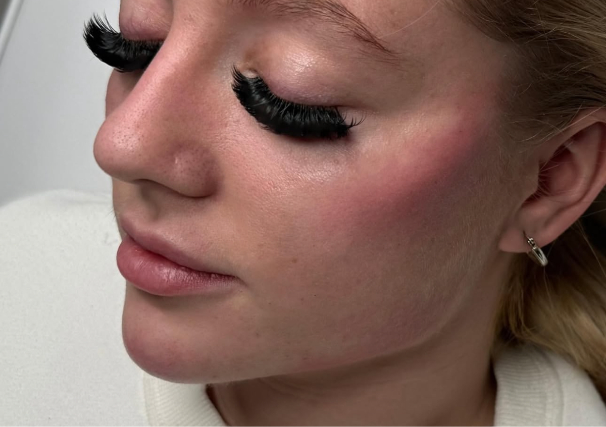 ✨ 7.7ml – Full Face Glow-Up