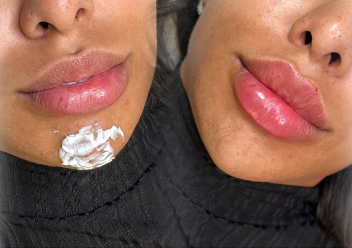 ✨ 2.2ml – Lift & Balance Package