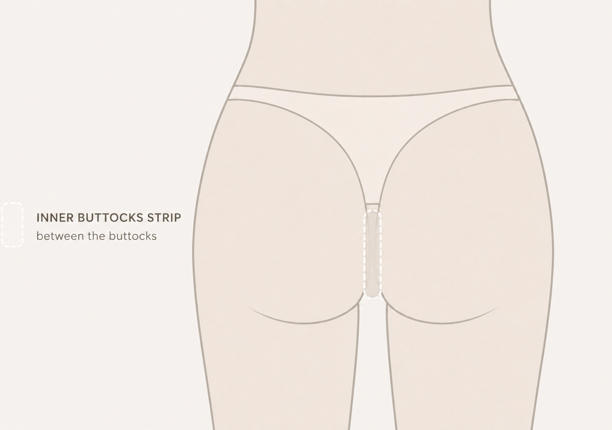 Inner Buttocks Precision Removal  