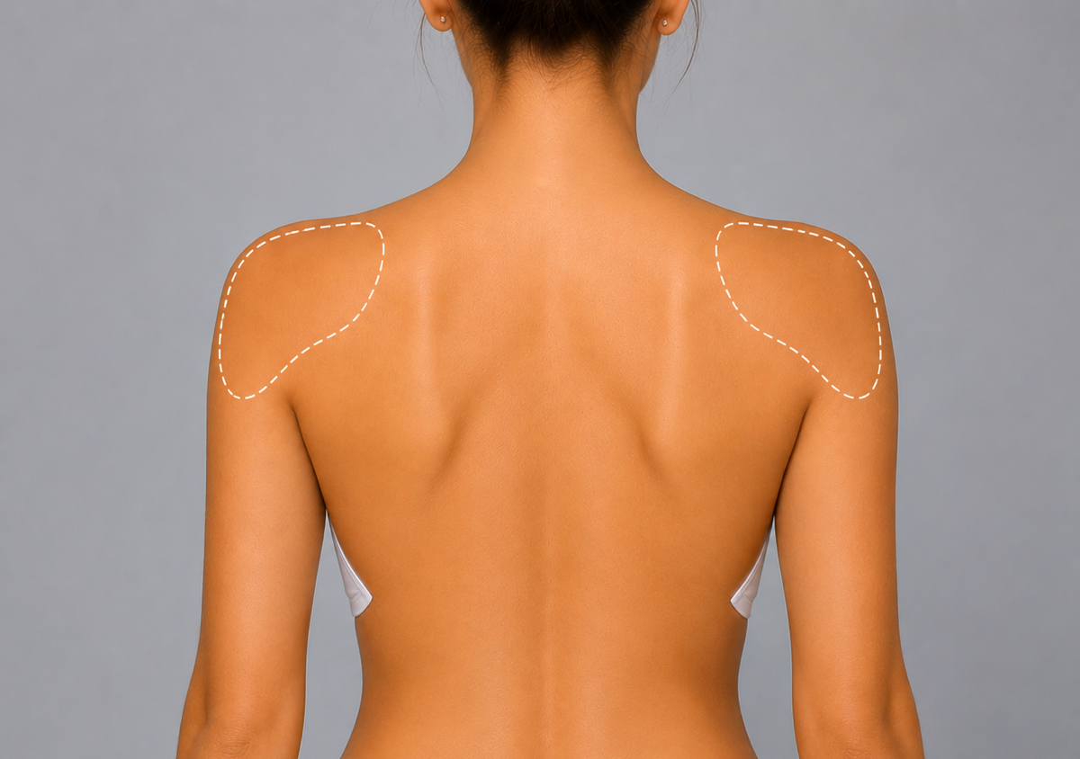 Shoulders Express Removal