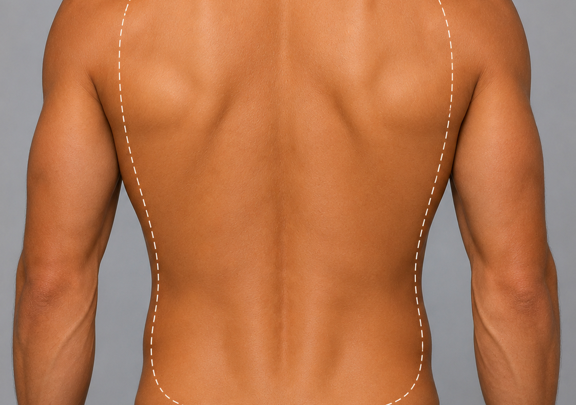 Full Back Hair Removal - Male Anatomy