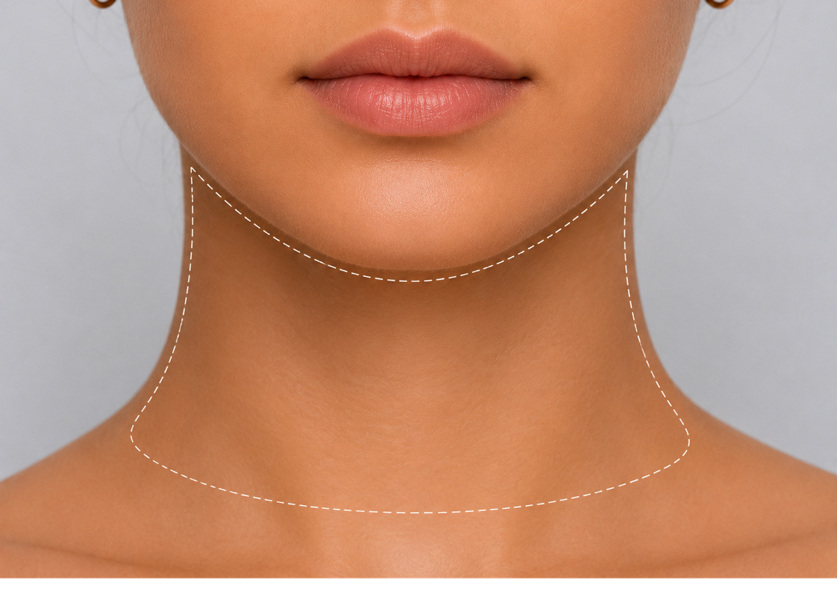Neckline Sugar Removal