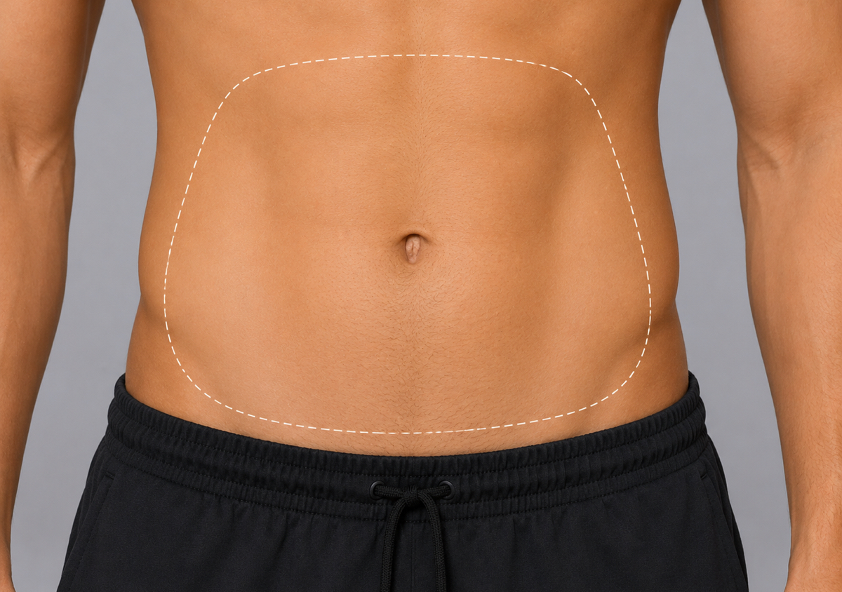 Stomach Express Hair Removal - Male Anatomy