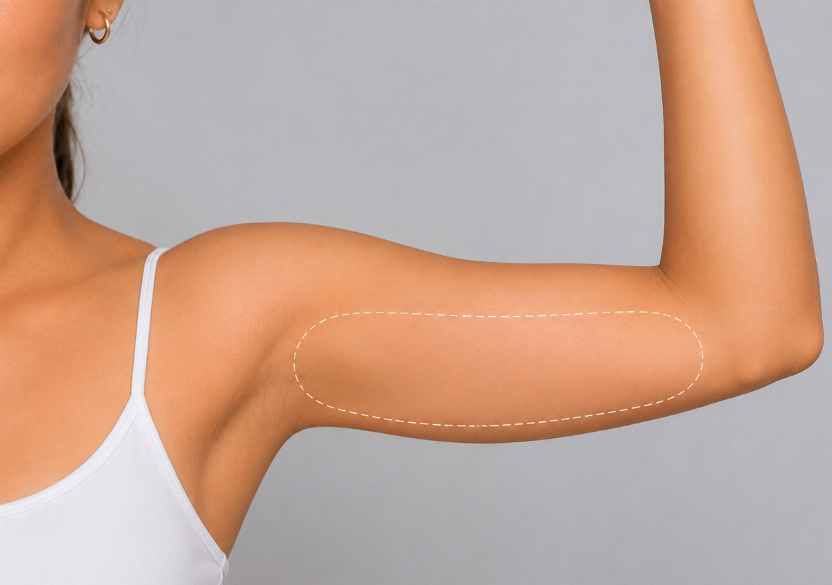 Half Arm Express Removal