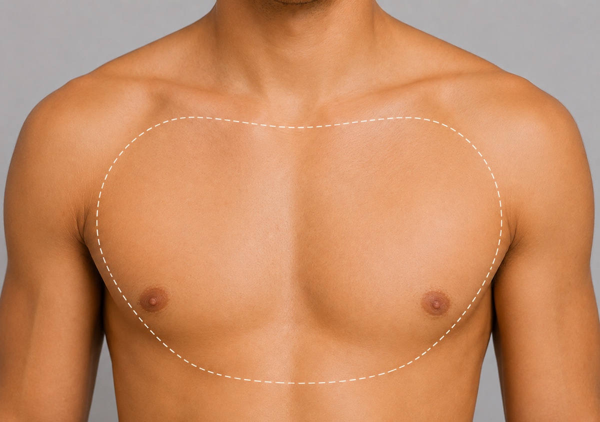 Chest Hair Removal - Male Anatomy