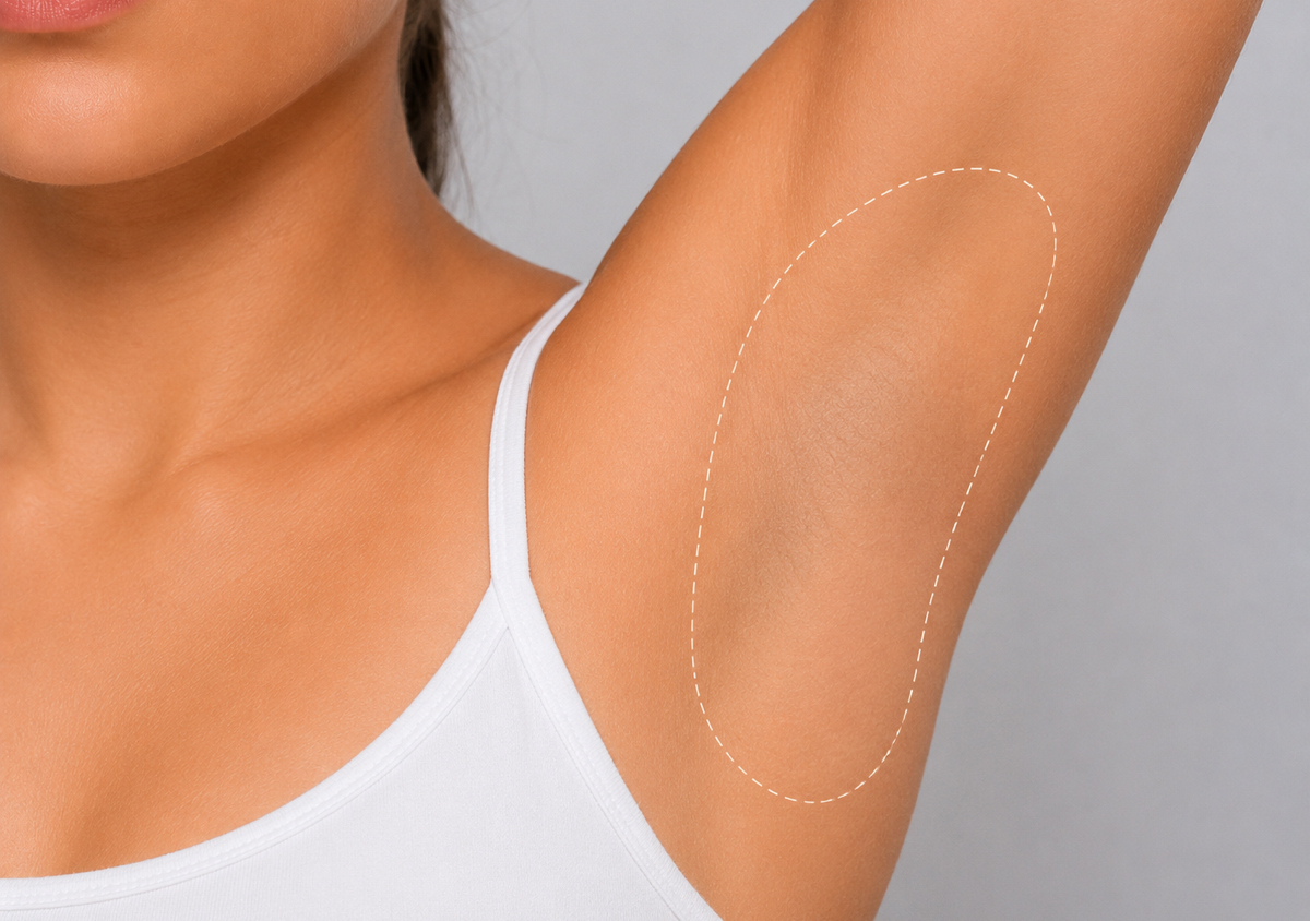 Underarms Precision Removal