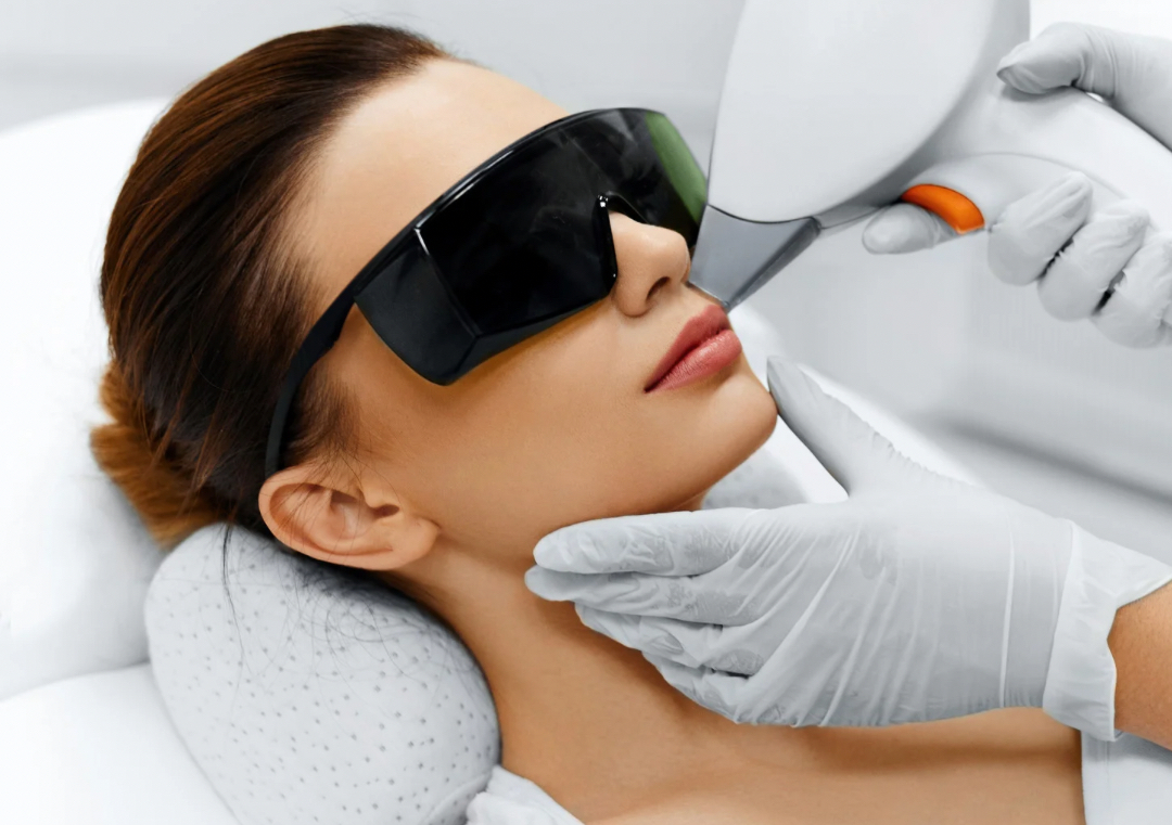 SKIN PERFECTION  LÁSER DIODO