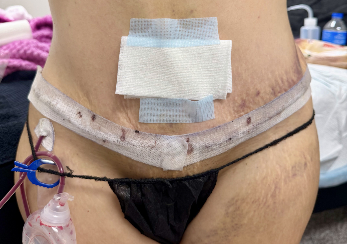 ✨ PAQUETE 8 SESIONES | POSTOPERATORIO💕