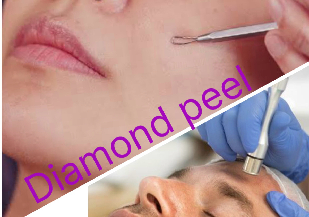 Diamond peel with pdt light 
