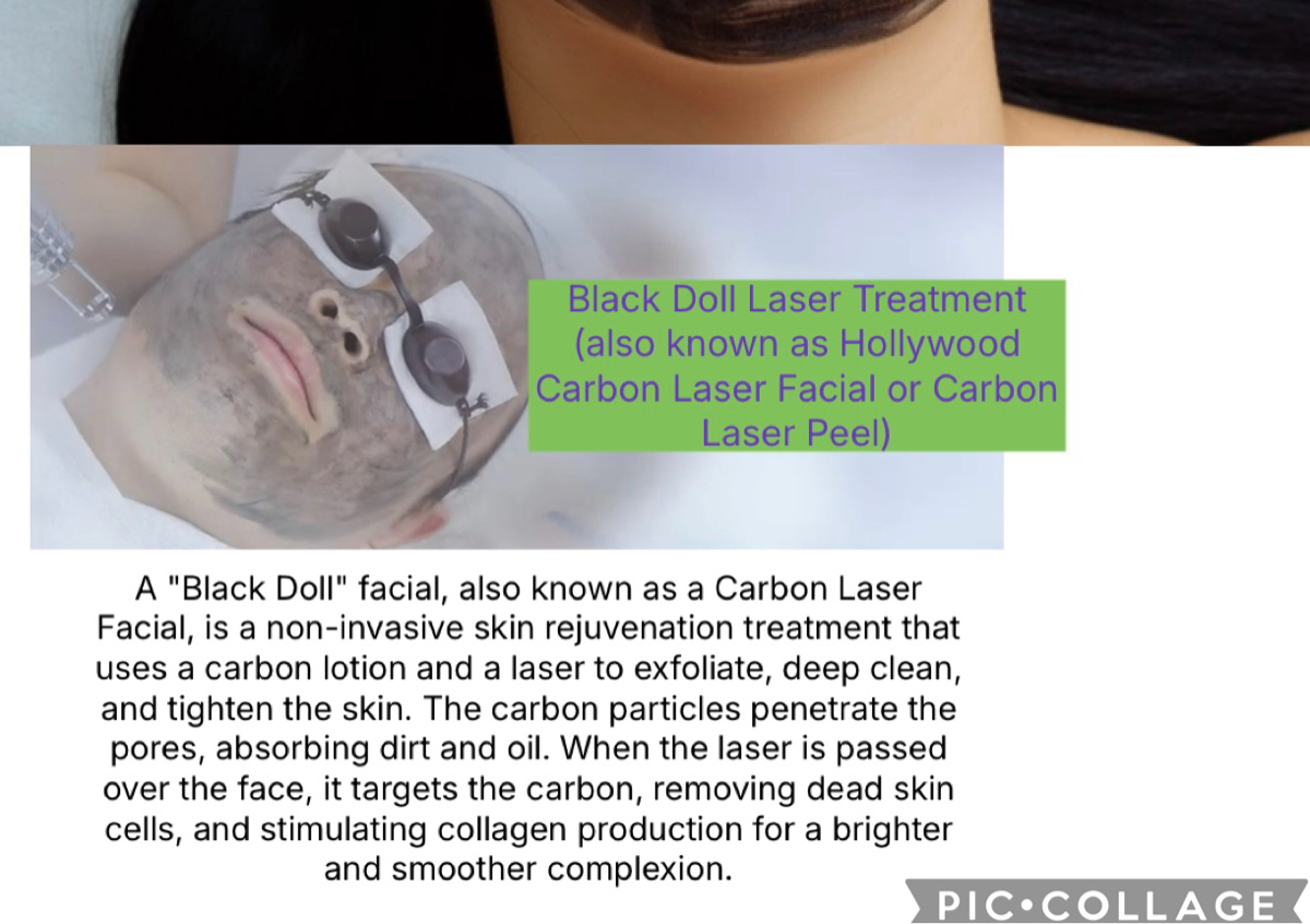 Black doll facial/hollywood facial with pdt light 