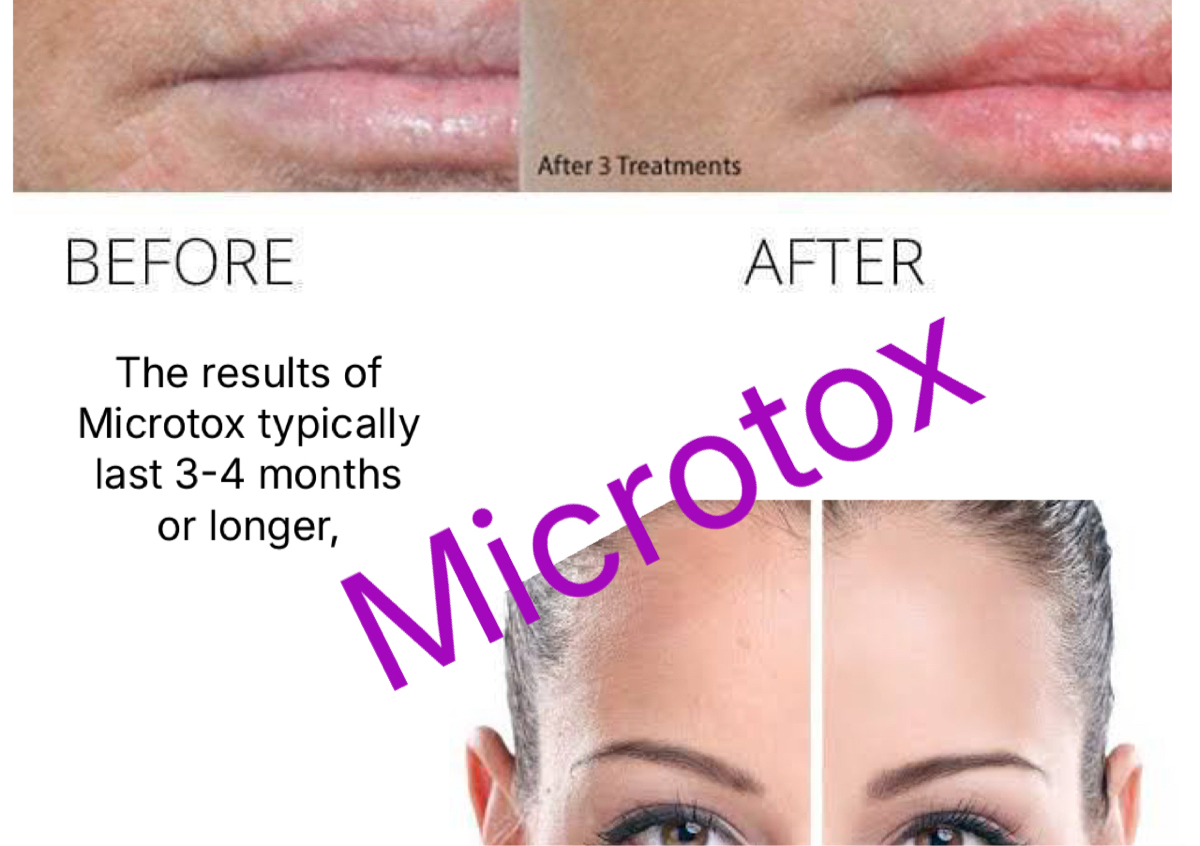Microtox  with pdt light