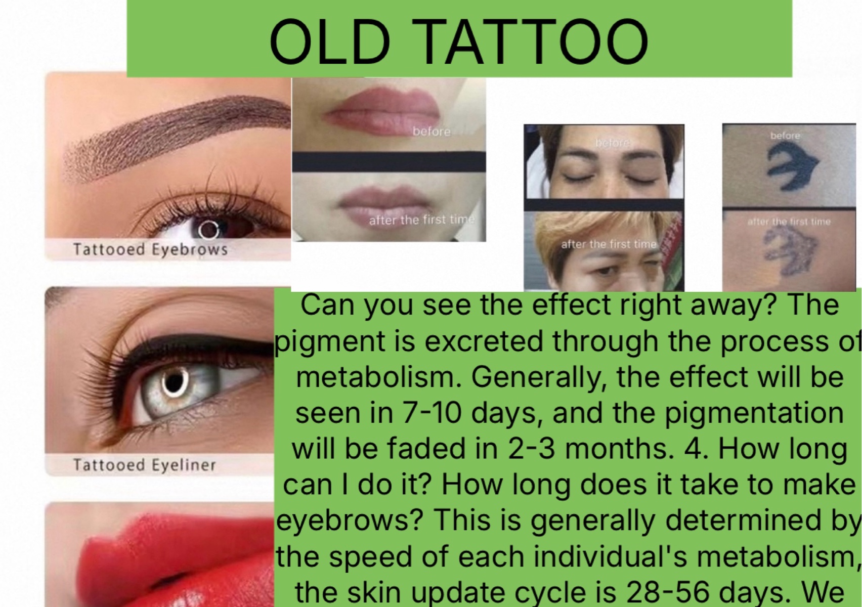 Saline Tattoo removal treatment