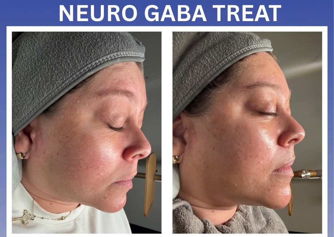 Facial Firm & Renew