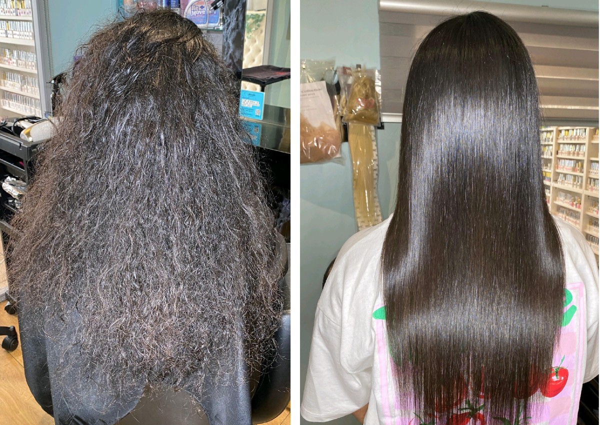 NANOPLASTIA mid back length 