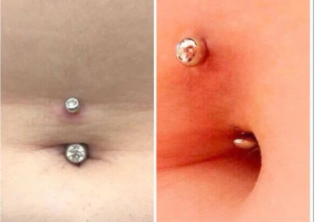 Navel (belly) piercing 