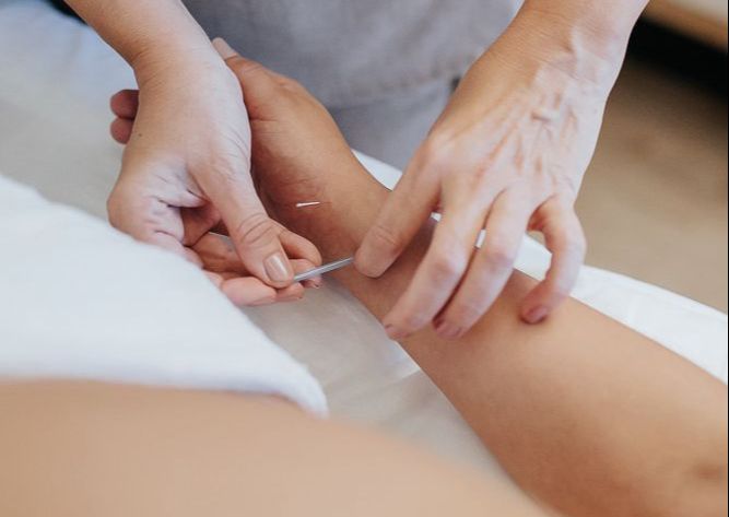 ACUPUNTURA PARA CICLOS FEMININOS E MENOPAUSA