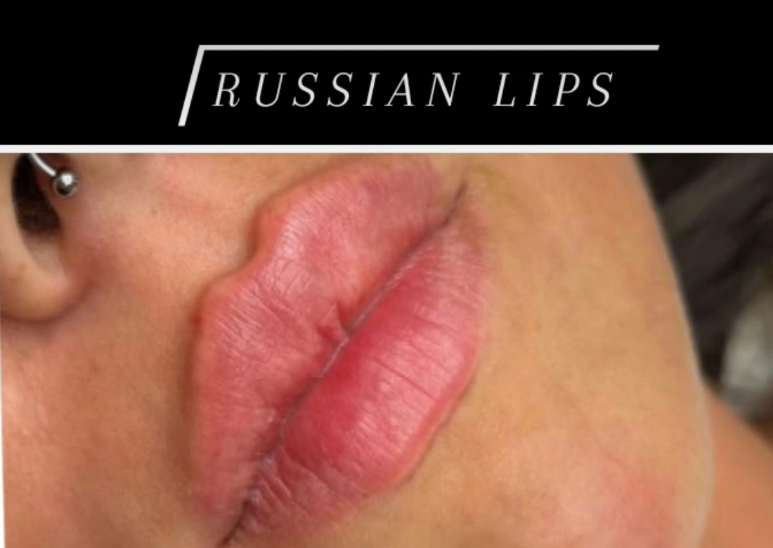 Russian Lips