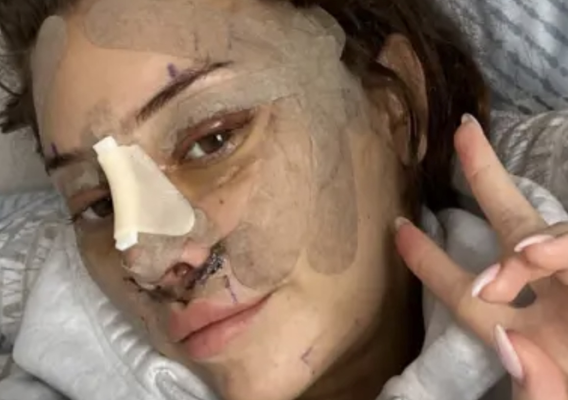 Post Op After Surgery Care