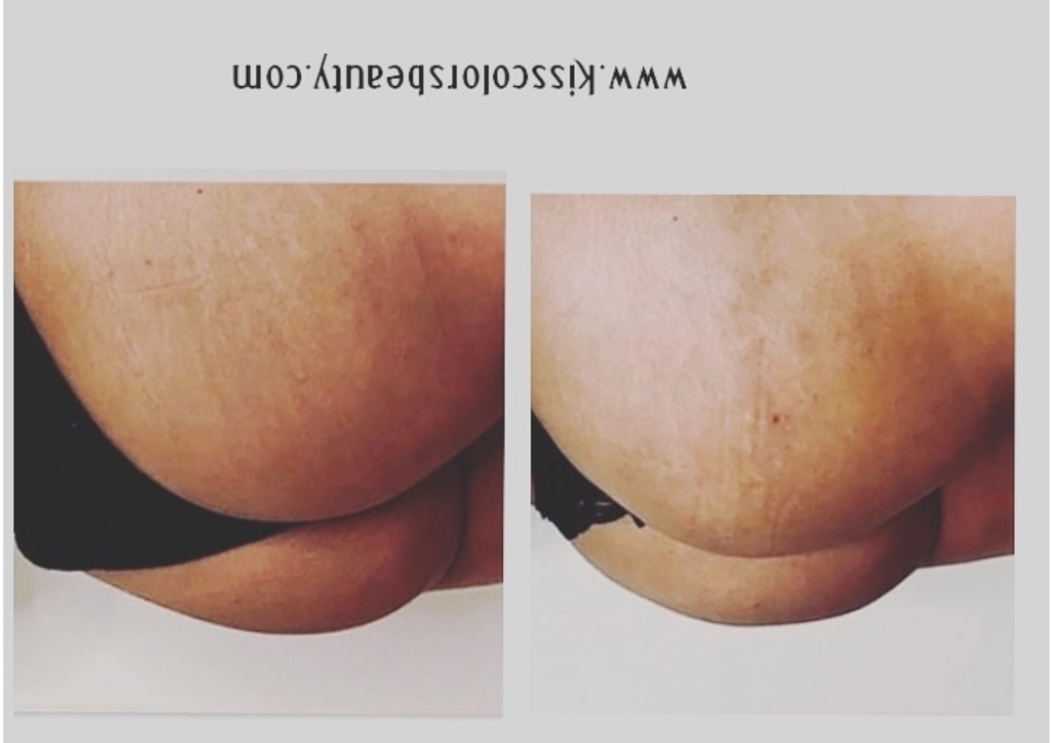   /Hydrocorp Butt Filler 