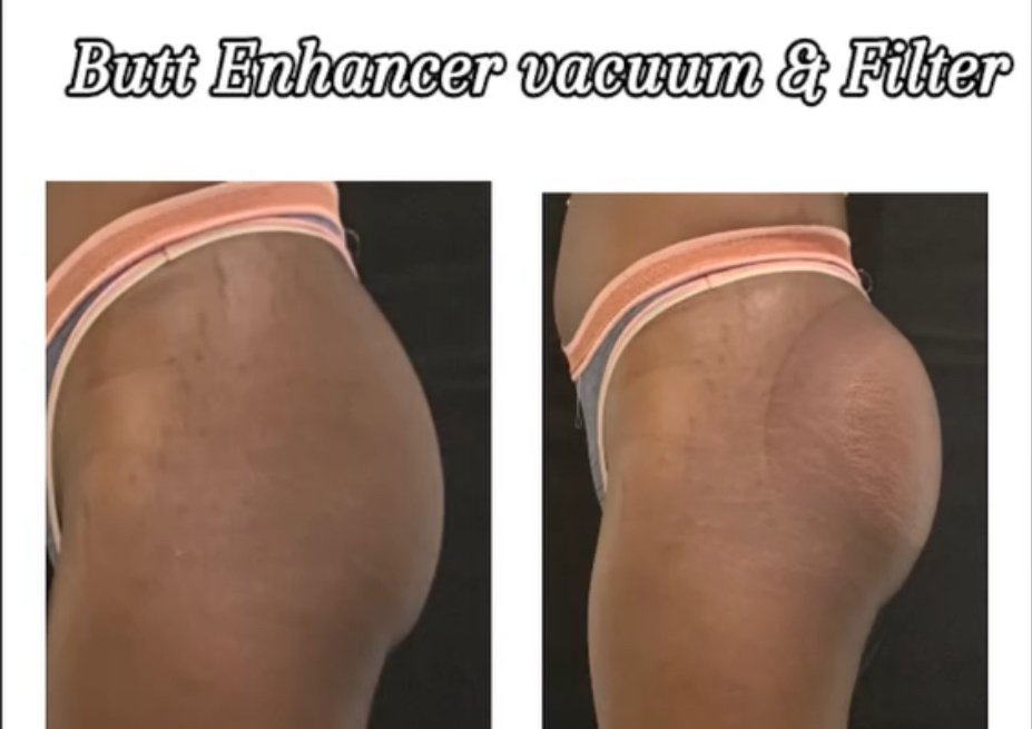 Vacuum butt plumping