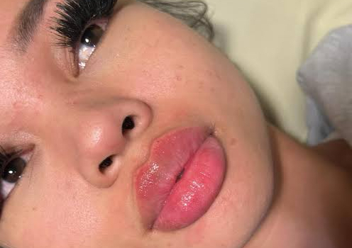 Lips 1 ml. 👄 & Lashes