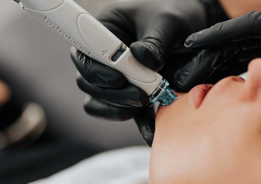 Hydradermabrasion
