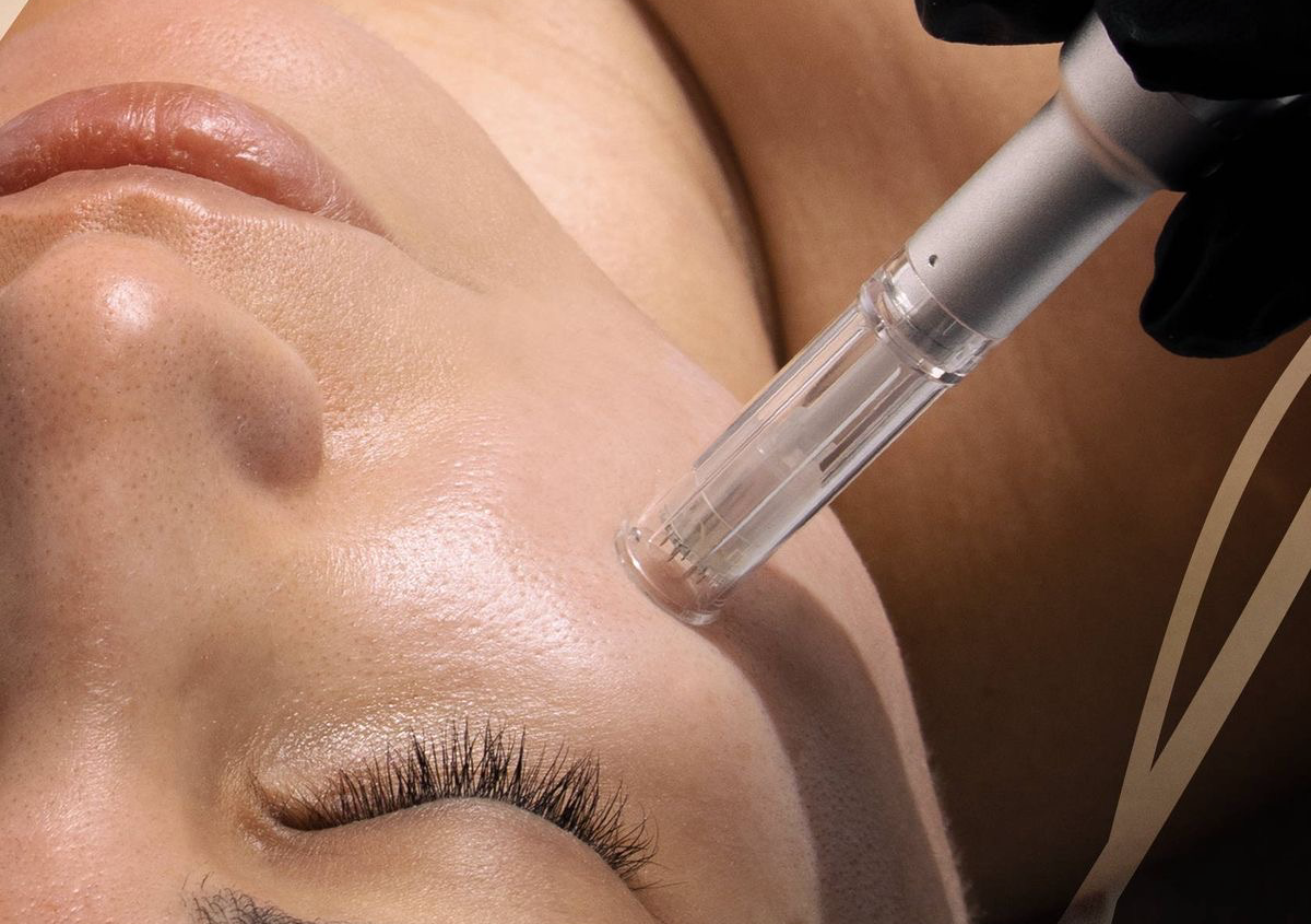 Dermapen Facial (microagujas)