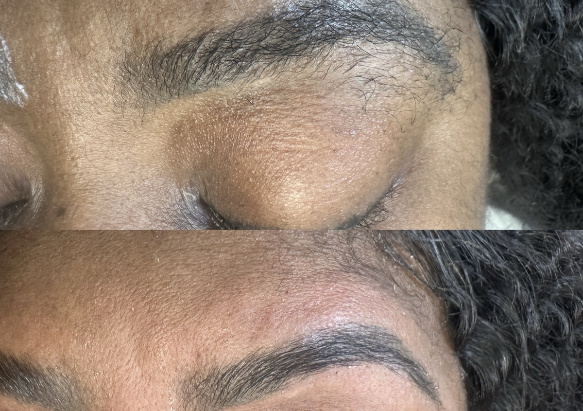 Brow Lamination (3/3)
