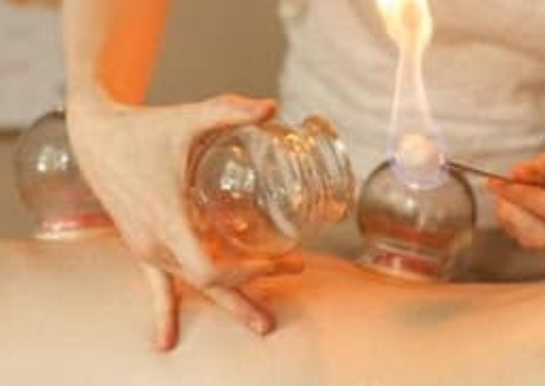 ADD ON Cupping Russian Flame Cupping