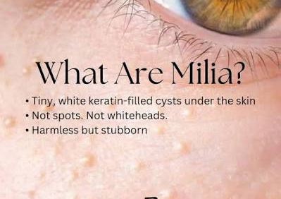 ✨ Advanced Pore Clarifying Treatment (with Milia Extraction)