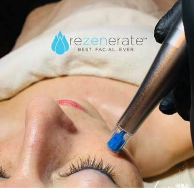  Rezenerate NanoFacial 