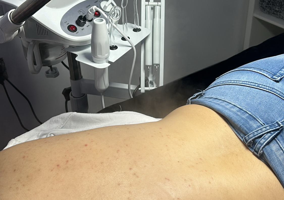 DEEP CLEANSE: ESPALDA