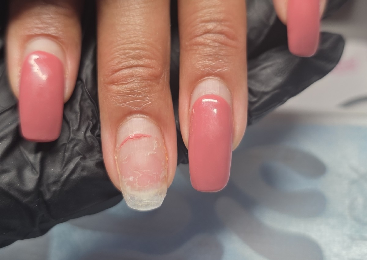 Reparatur nails