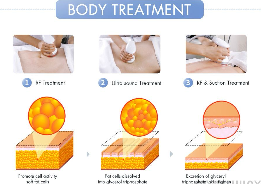 Curvy Snatch Package 6