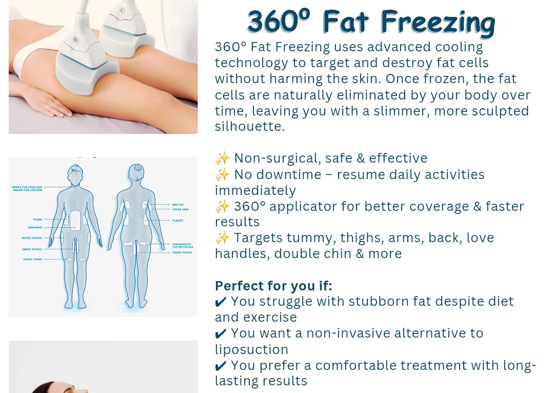 360⁰ Fat Freezing 