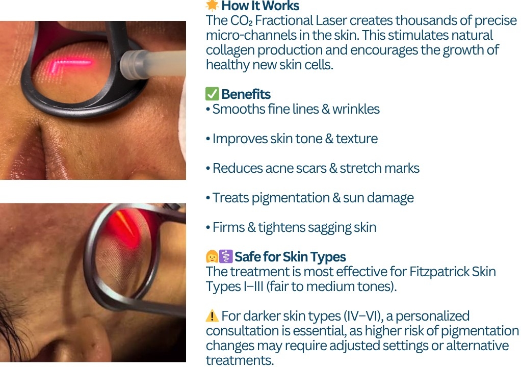Fractional CO2 Laser