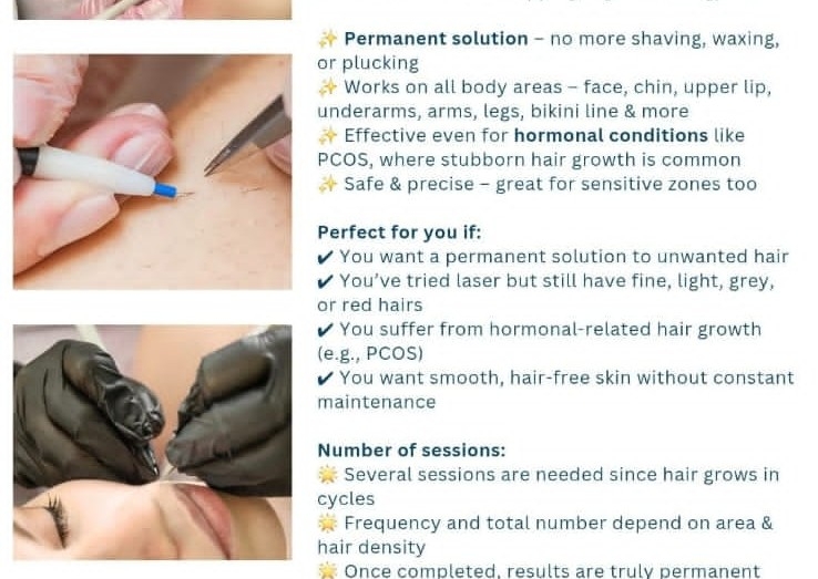 Electrolysis Hair Removal 