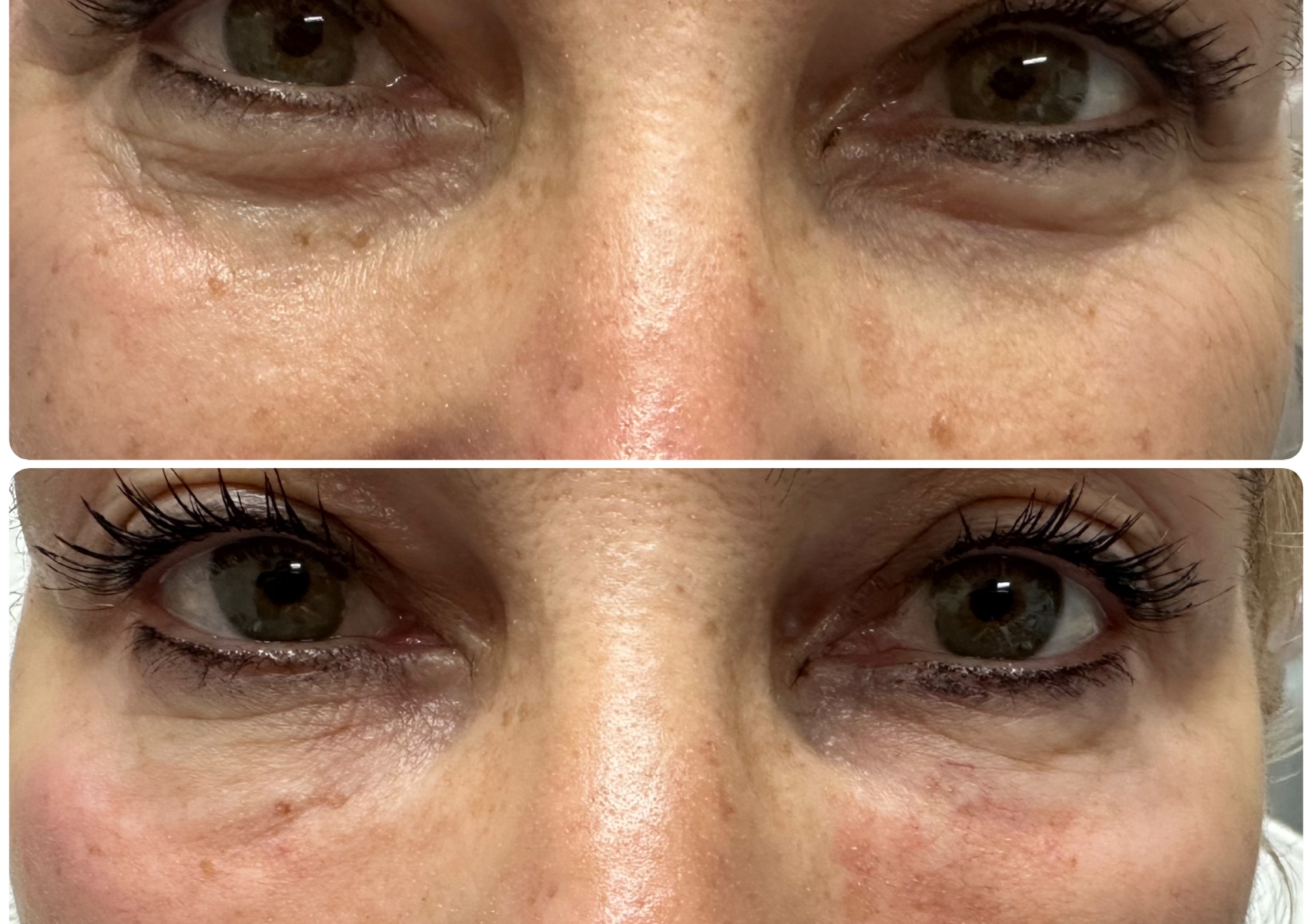 Rystaline eyelight filler 