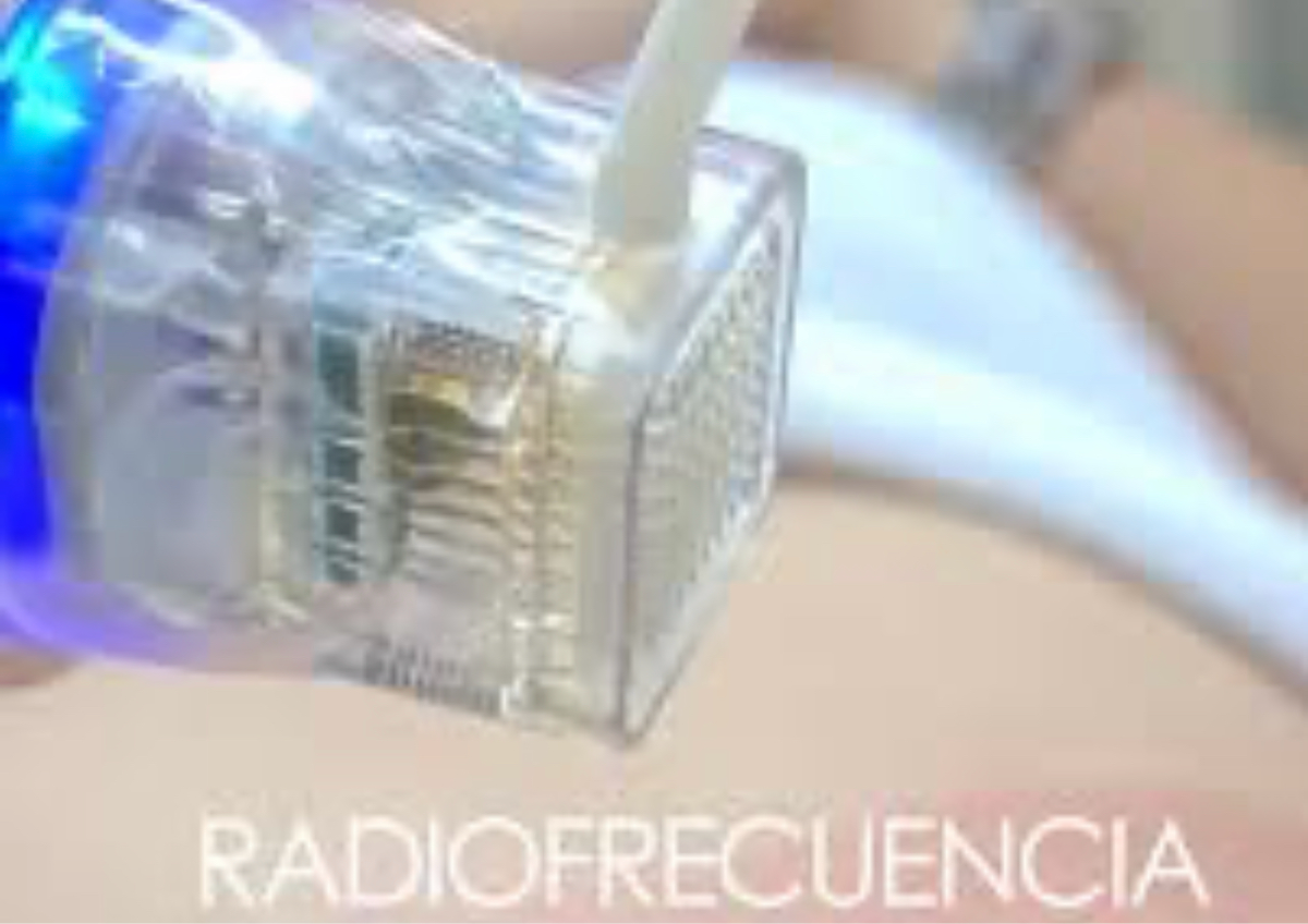 Radiofrecuencia fraccionada abdomen 