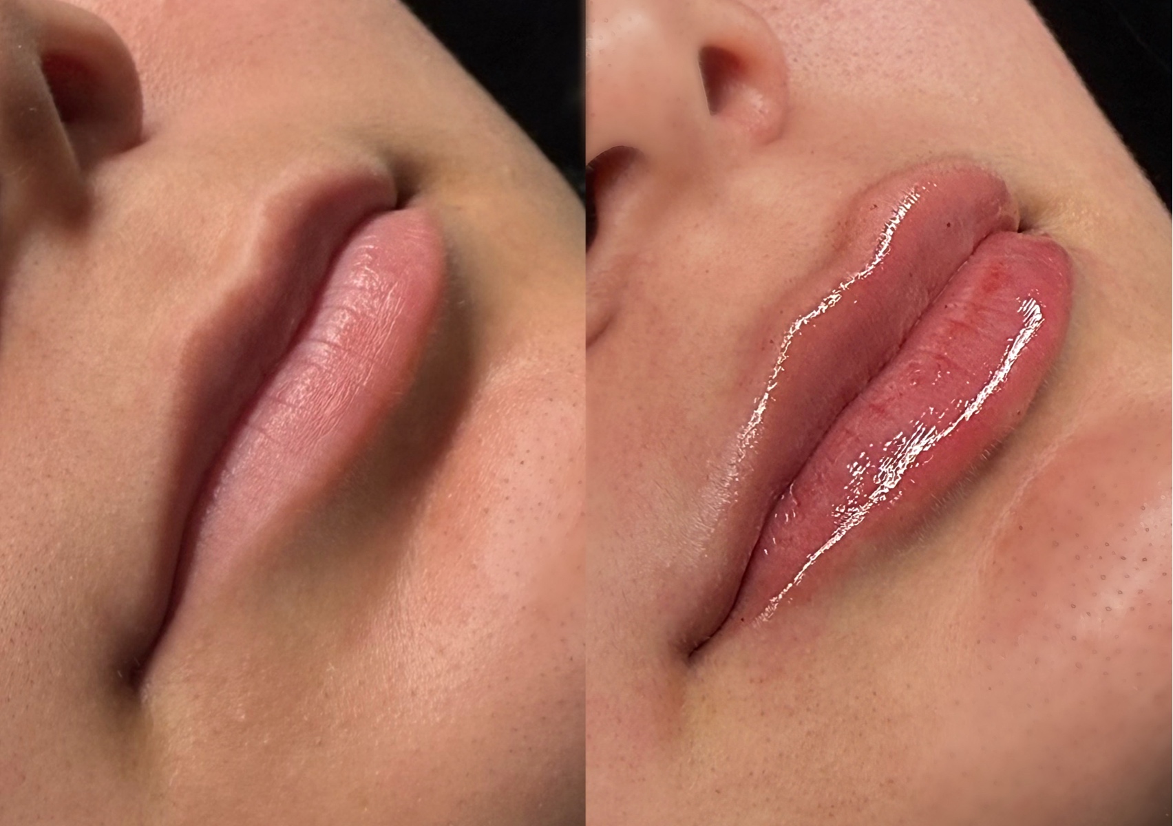 HIDRATACIÓN DE LABIOS 