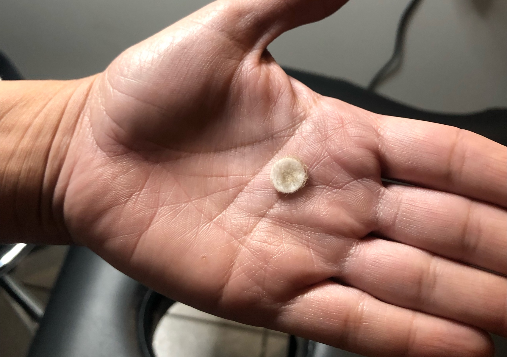 Microdermabrasion - Add On