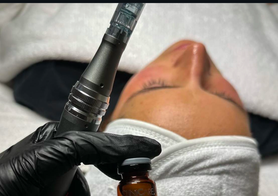 Microneedling - Firming 