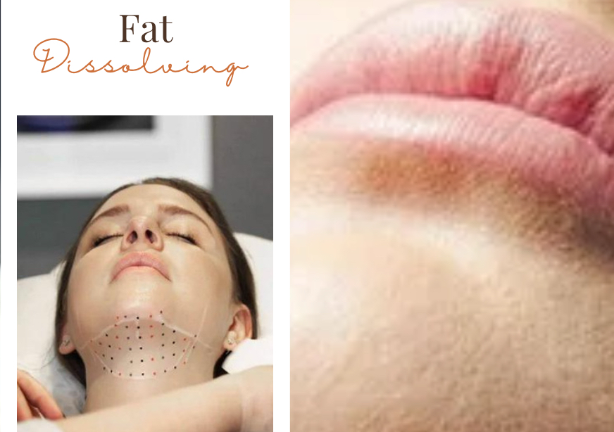Fat Dissolving 