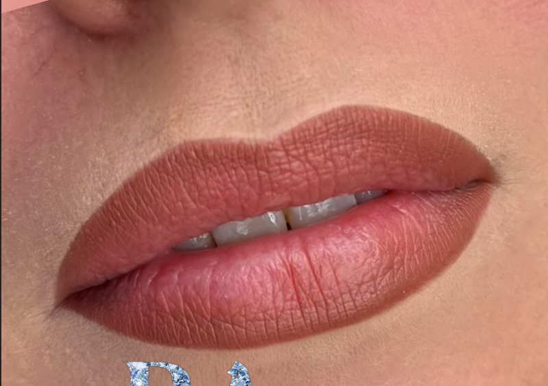 Retoque Labios 